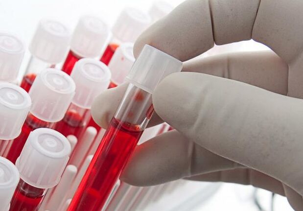 аналіз крові після вживання алкоголю